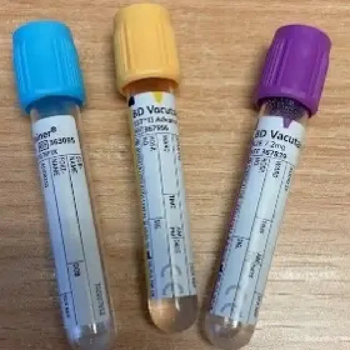 blood test tubes